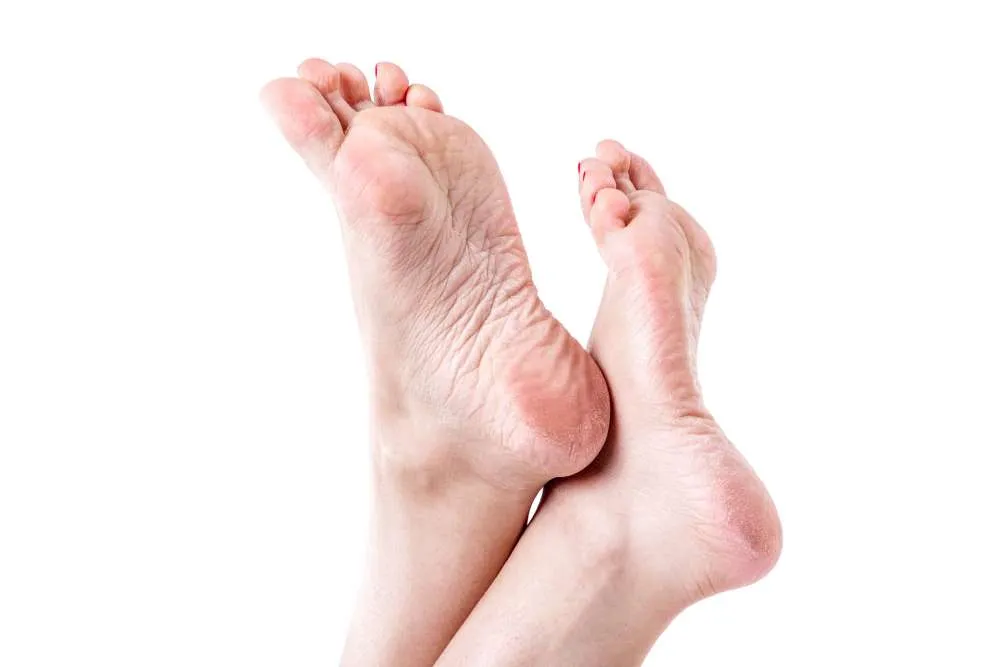 Soin Anti-Callosités pieds